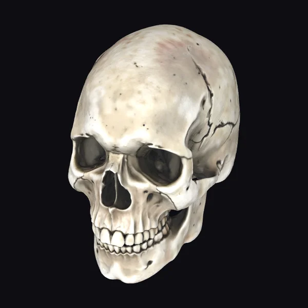 Cracked Male Skeleton Head