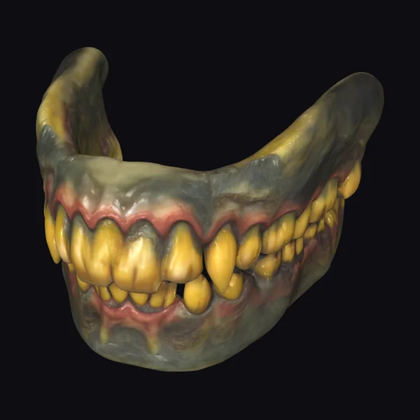 Zombie Teeth Dental Prosthesis