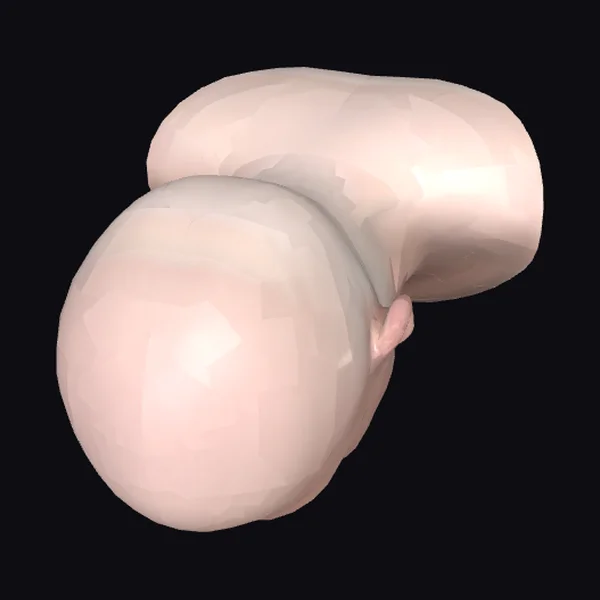 Pink Bladder Anatomy