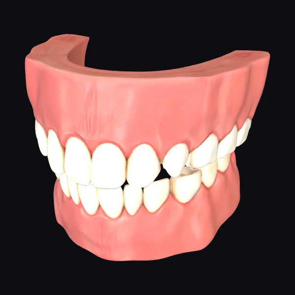 Open Mouth Teeth Model