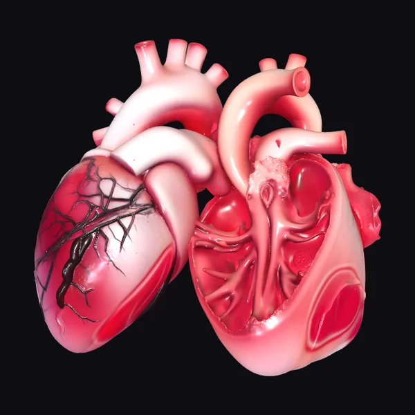 Anatomical Heart Pathology