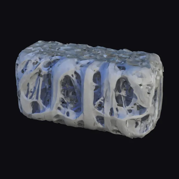 Twisted Block Structure